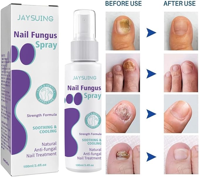Gentle Nail Fungus Remover Maxum